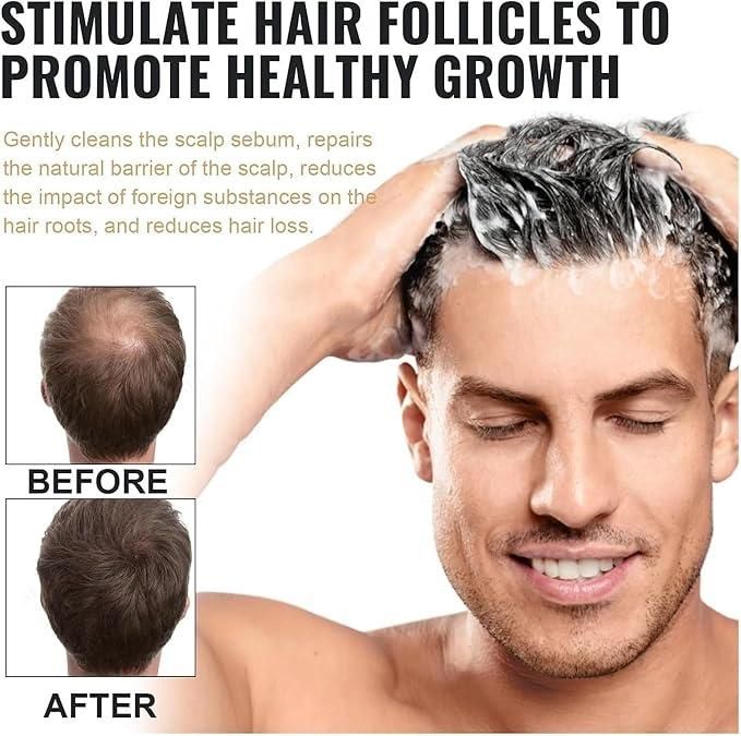 Root Activating Shampoo 100ml - Hair Growth Stimulating Shampoo for Deep Nourishment & Volume